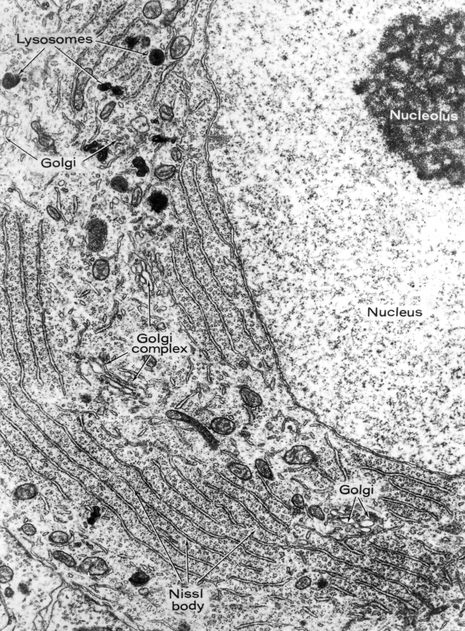 Neuronal cell body
