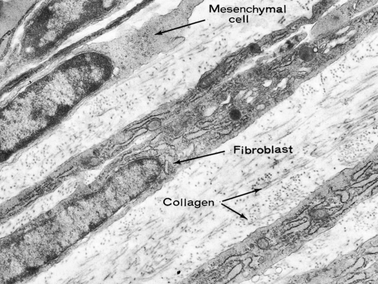 Fibroblasts in Developing Connective issue