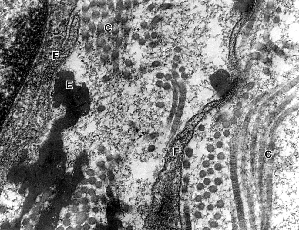 Connective tissue matrix