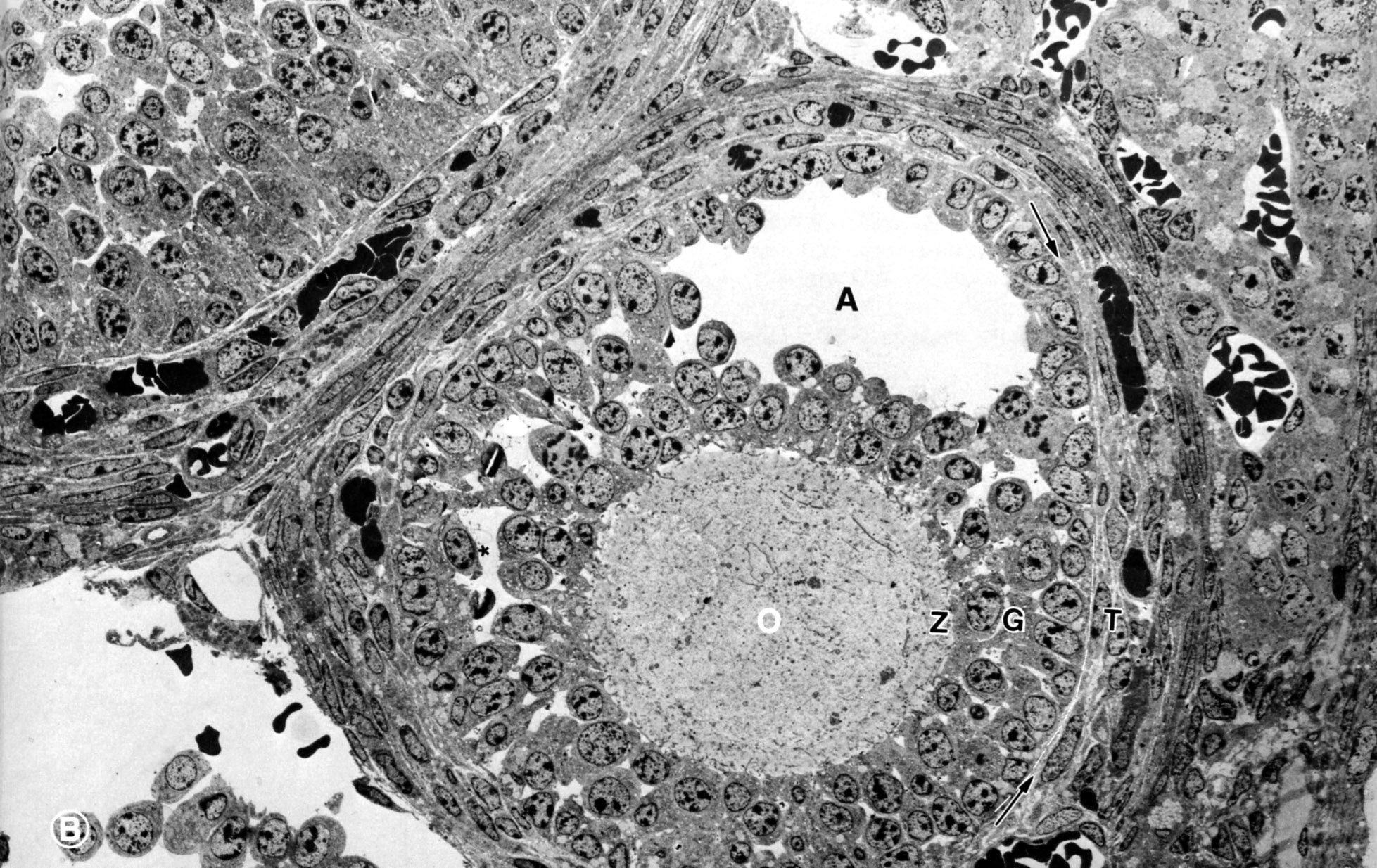 Secondary follicle