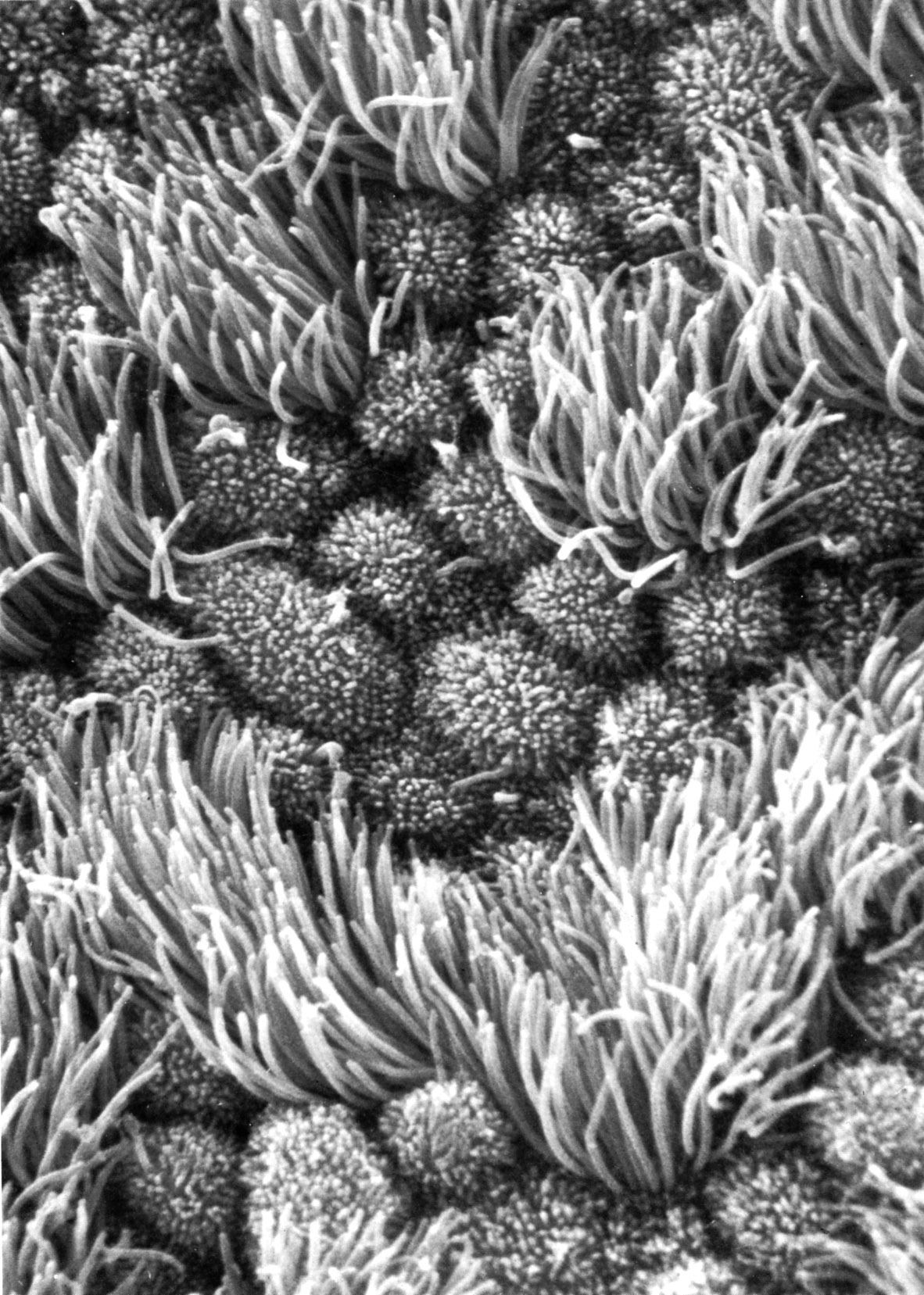 Epithelium of oviduct