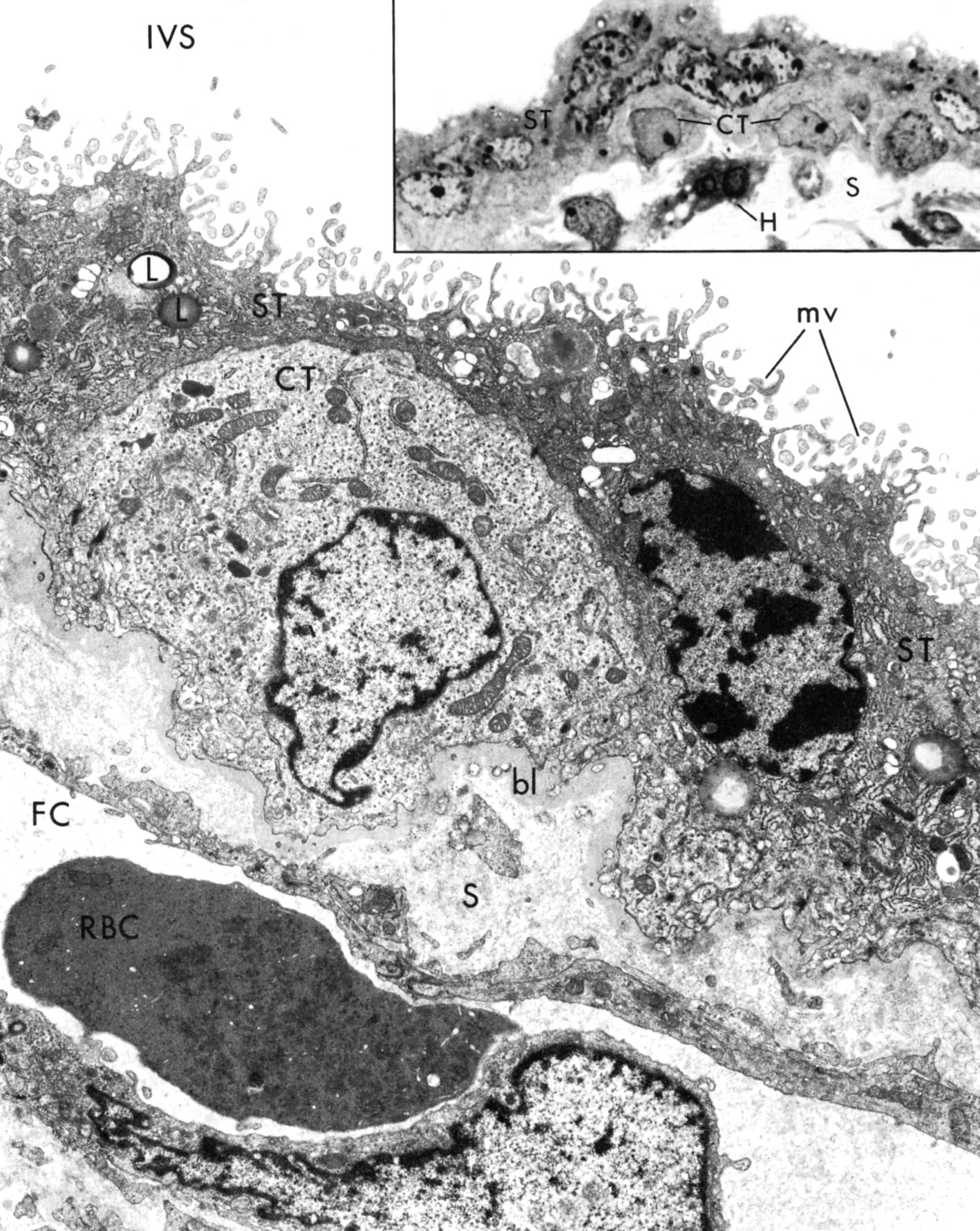 Placental barrier between maternal and fetal blood