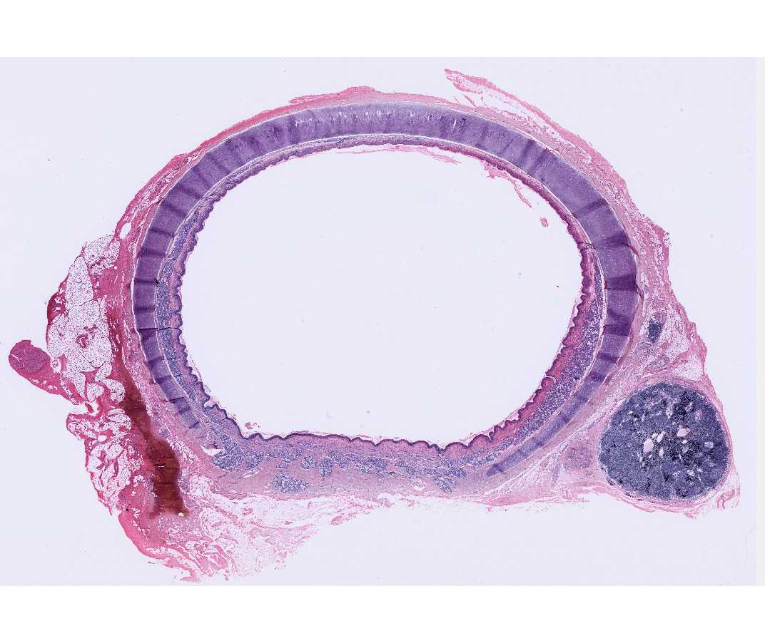 #5 Trachea and Esophagus, Human