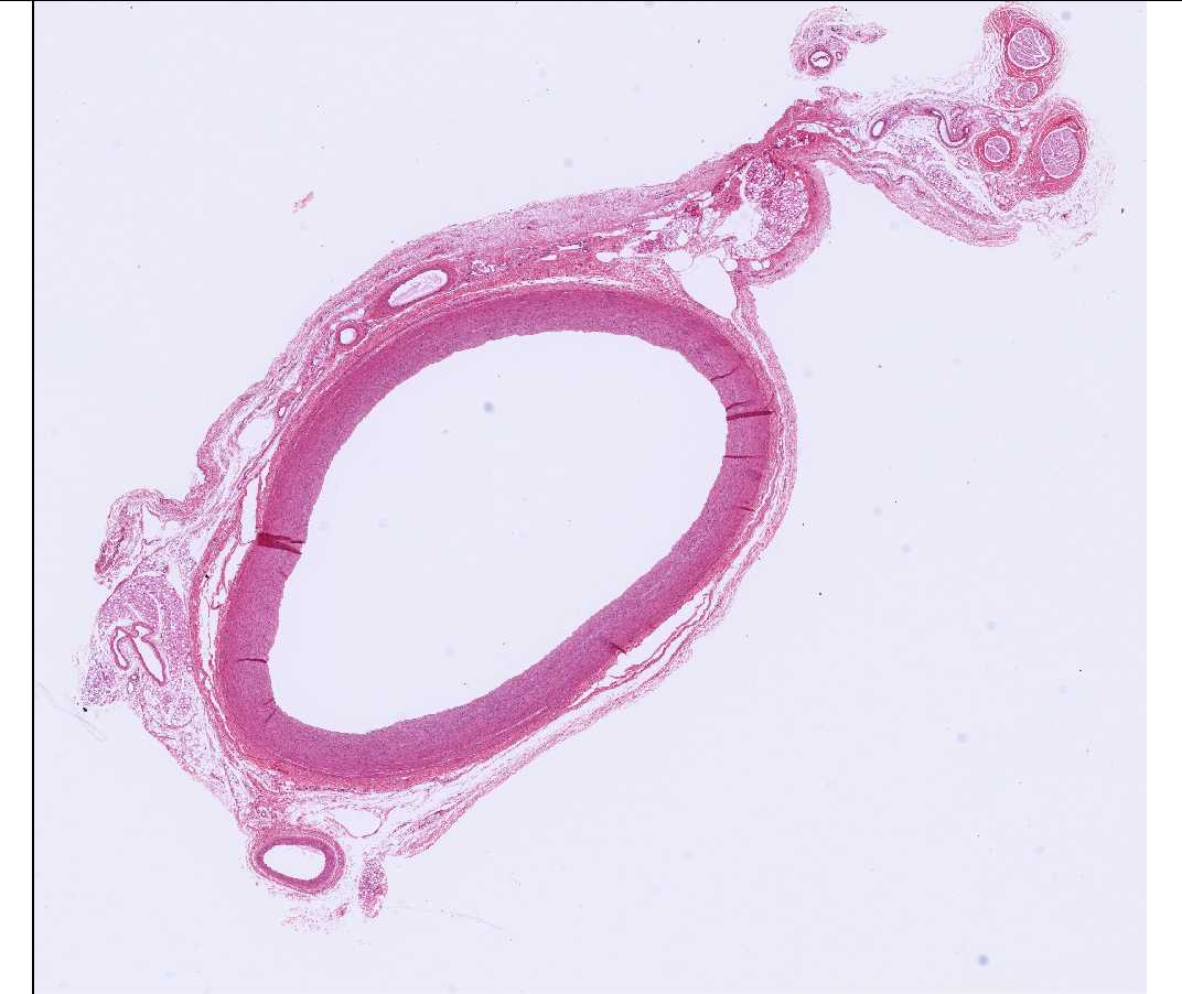 #16 Aorta, Monkey