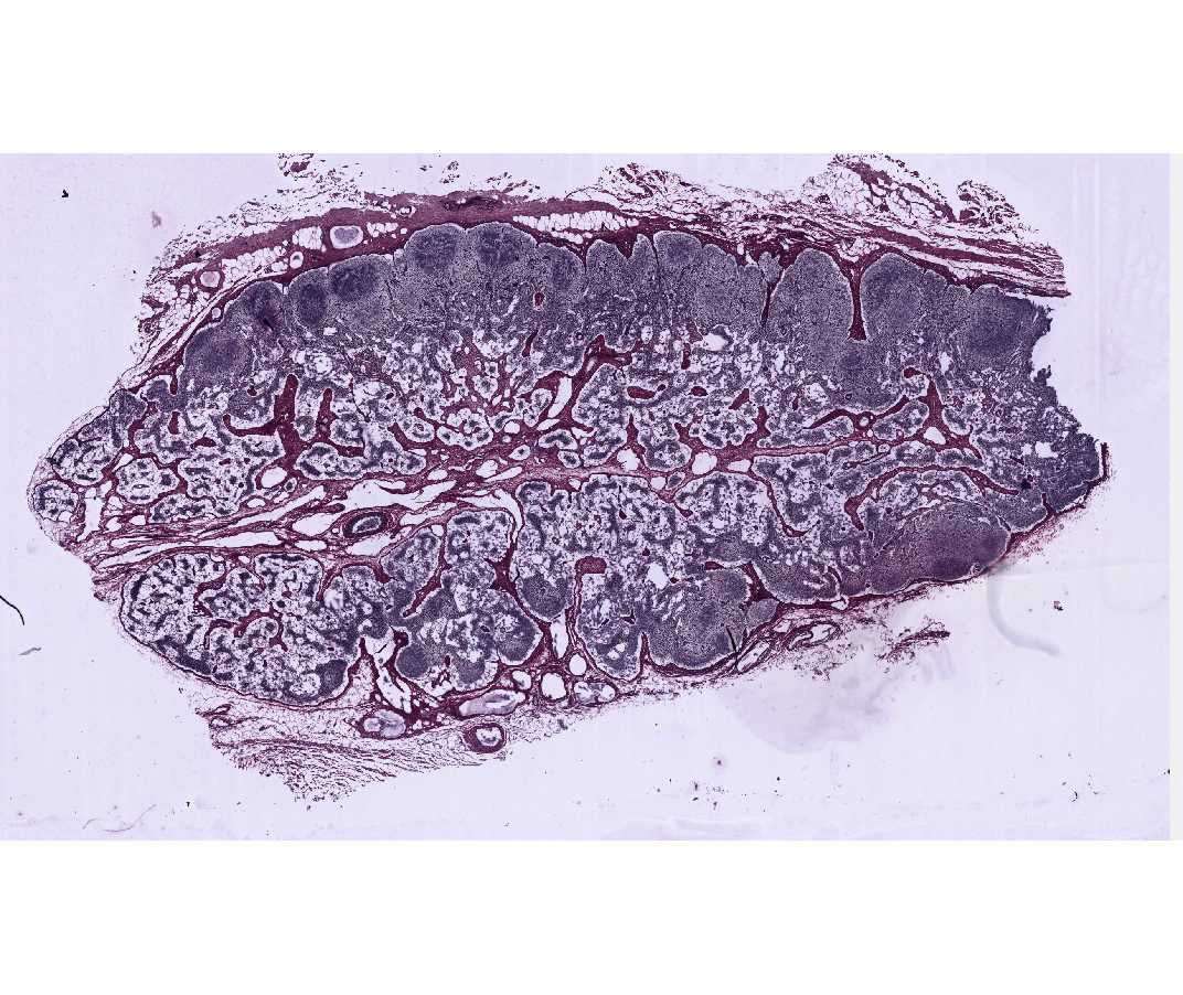 #22 Lymph Node, Dog (Foot's Silver)