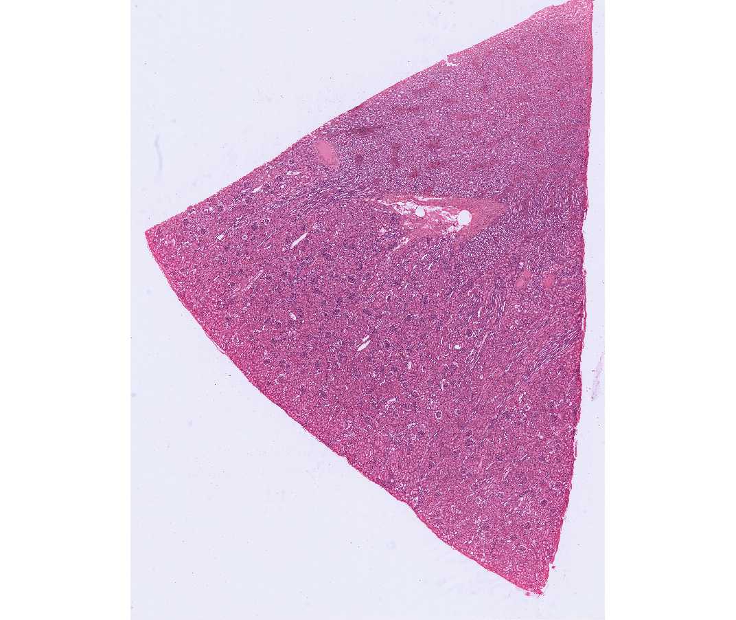 #49 Kidney, Human, H&E.  
