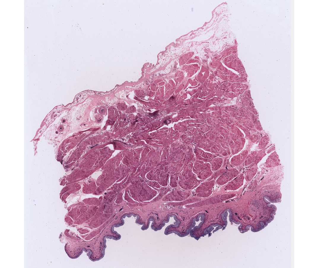 #54 Bladder, Human