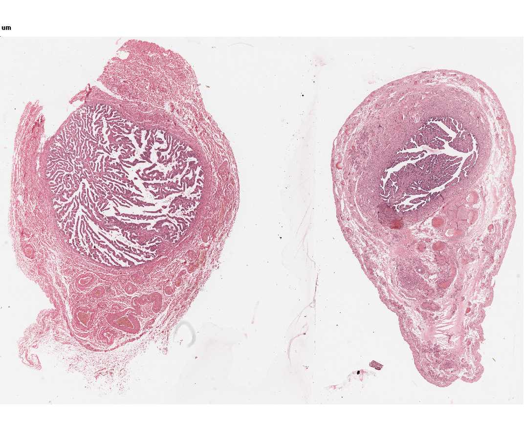#68 Oviducts (Fallopian tubes). Human H&E.