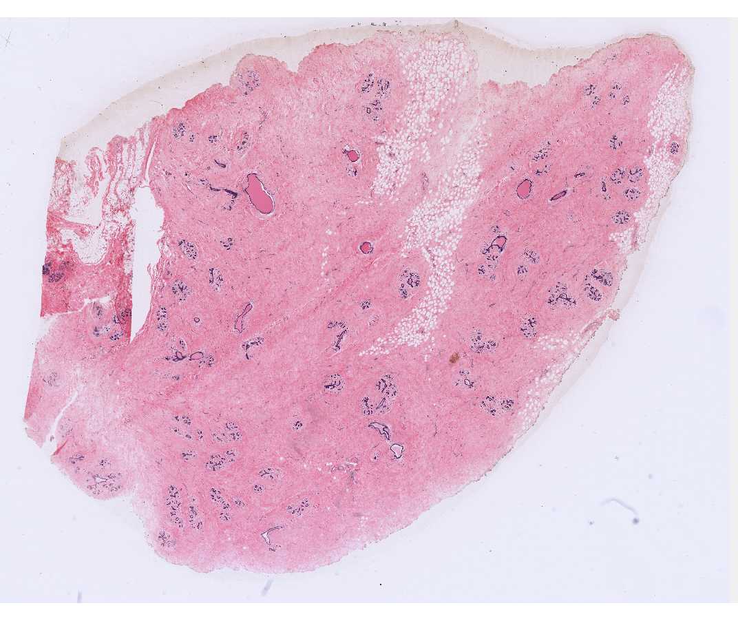 #70 Mammary Gland, Human, Inactive (H &E) 
