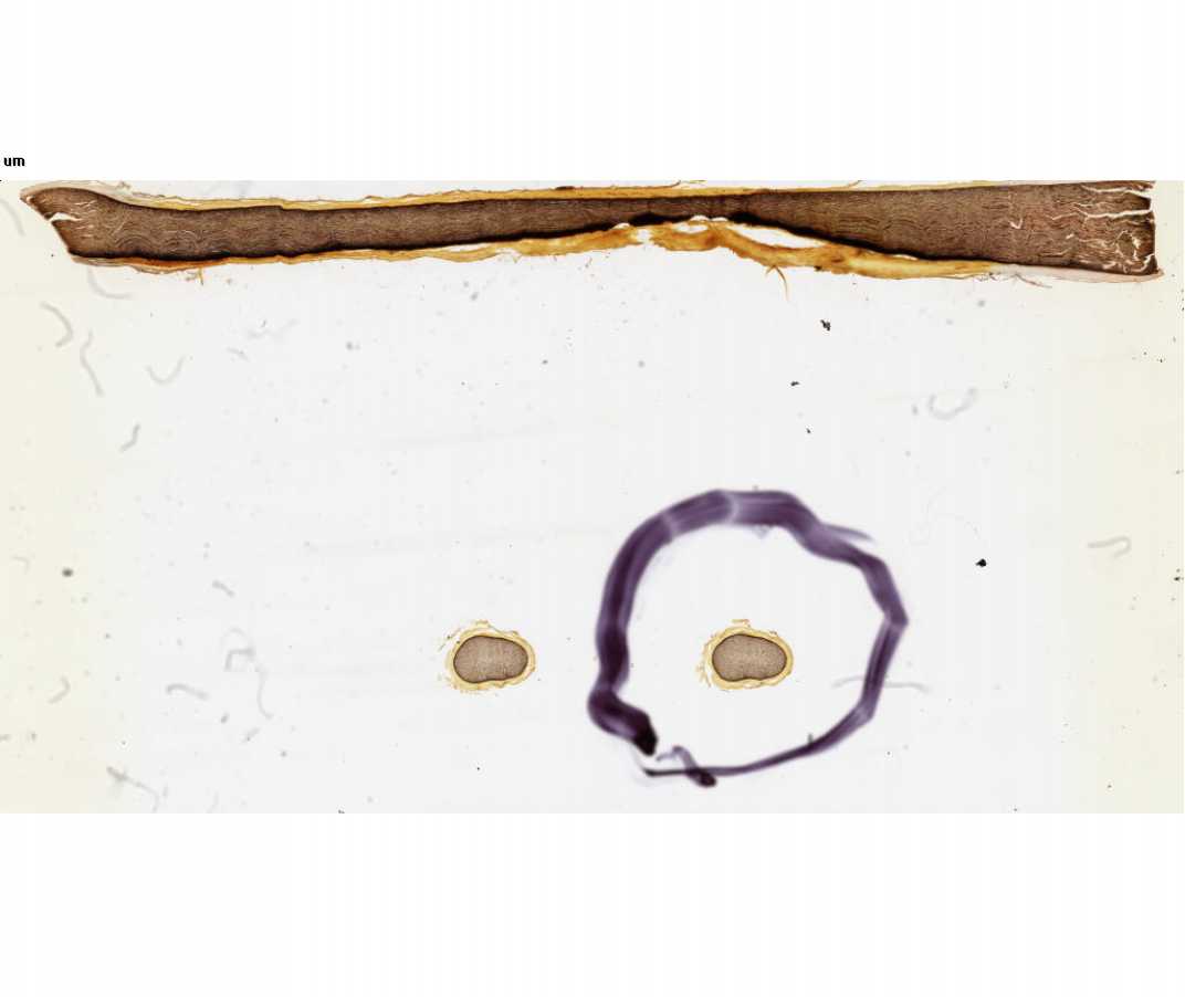 #80 Sciatic Nerve of Monkey, 2 sections (Cajal)