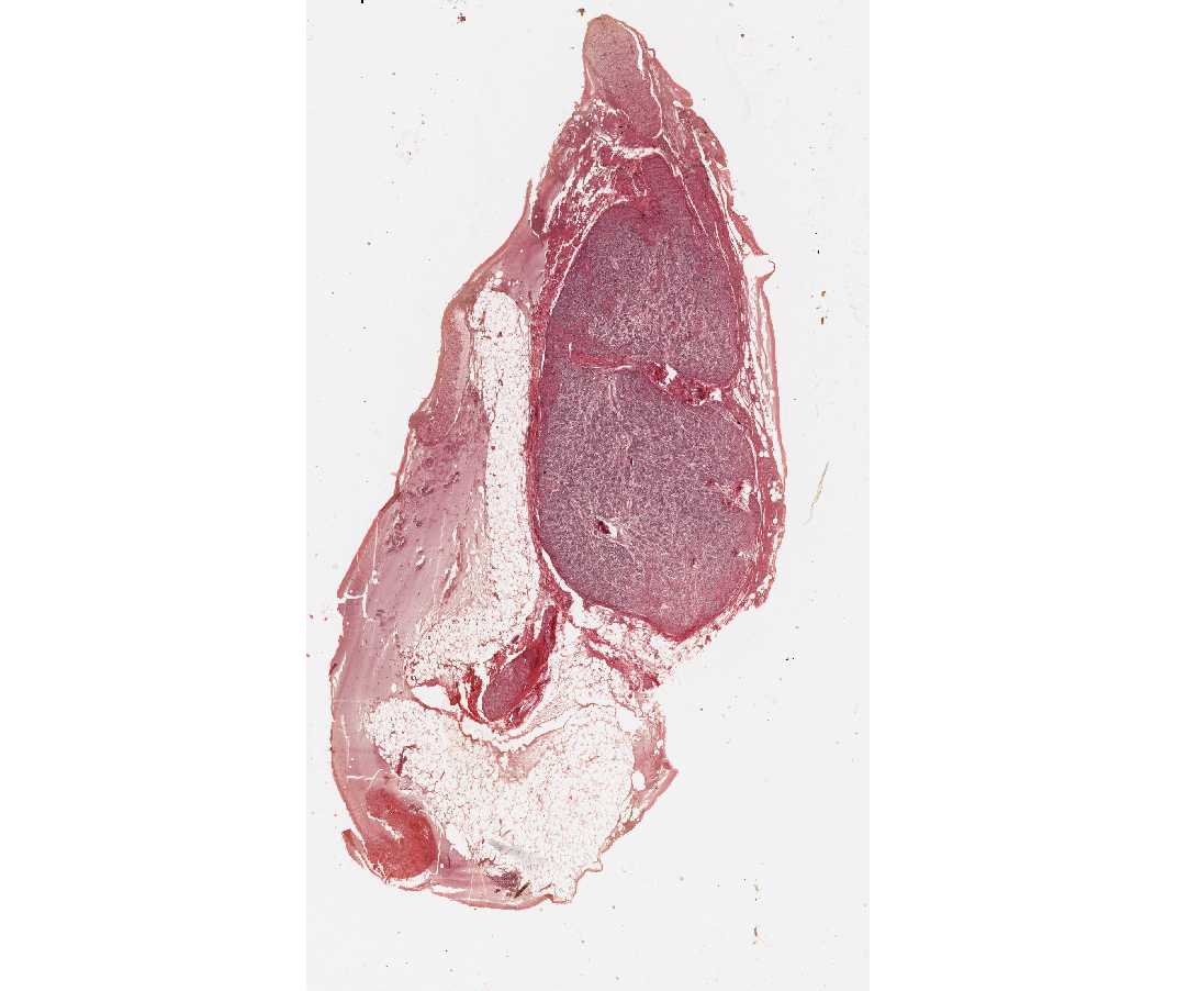 #83 Thoracic Sympathetic Ganglion, Human