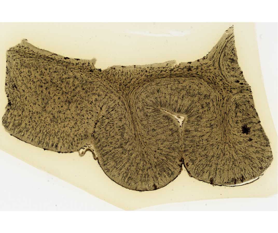#111 Cerebral Cortex, Cat, Golgi, 100m, Celloidin embedded