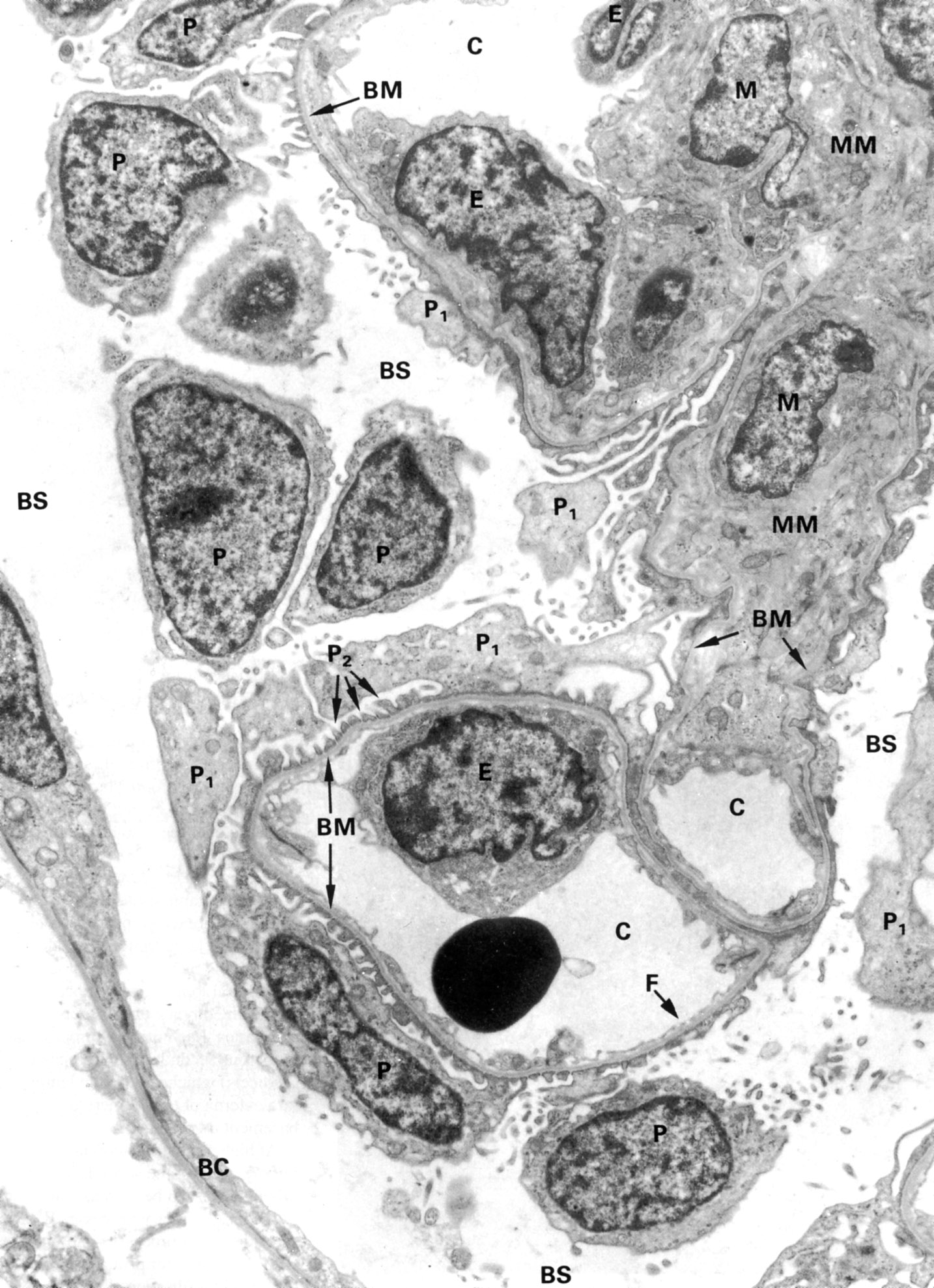 Bowman’s capsule and glomerulus