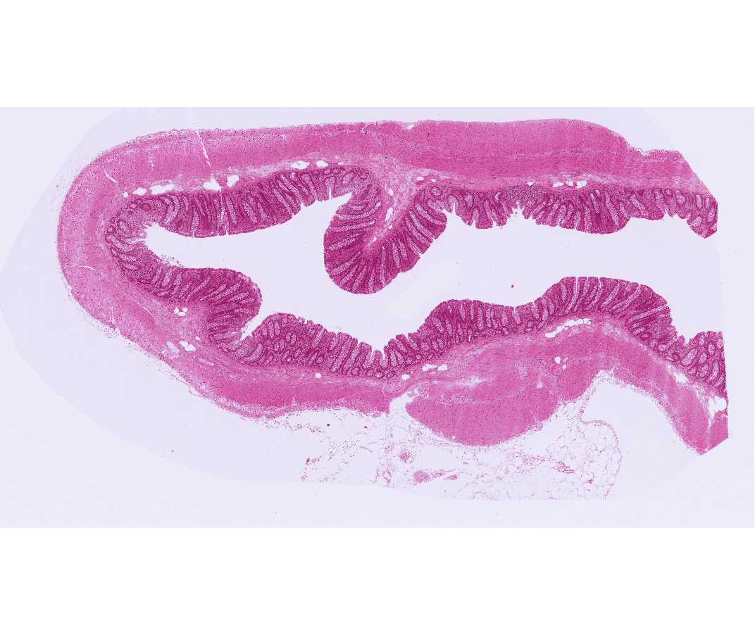 #39 Colon, Monkey (H&E, thin plastic section)