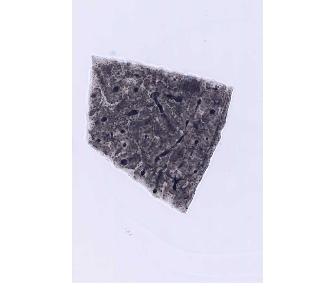 #9 Dried Bone, Shaft of Tibia, Human, no stain