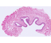 #32 Esophagus, H&E 